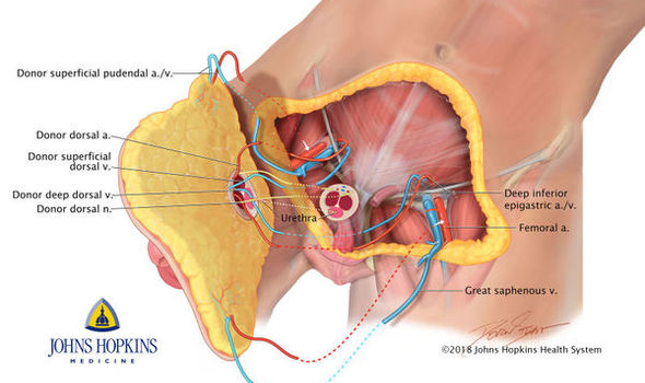 NEWS HEADLINES:  Breakthrough genital transplant surgery at Johns Hopkins